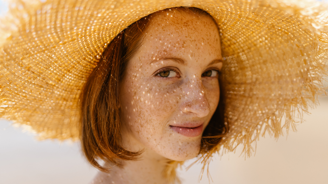 Solbari blog: What is photocontact eczema?