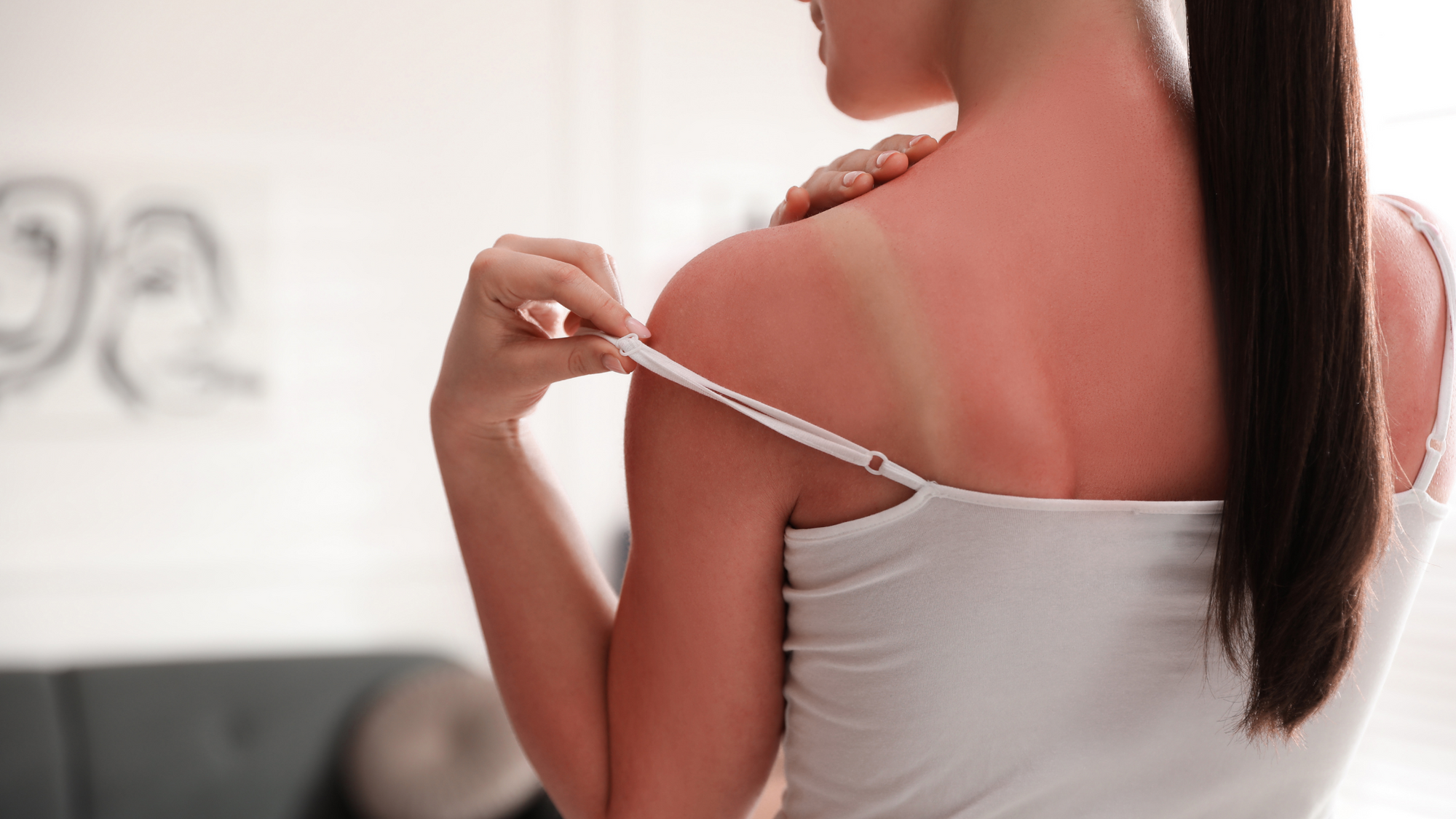 Why does sunburn hurt?